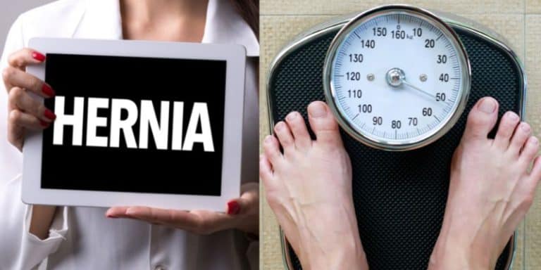 do-you-lose-weight-after-hernia-surgery-2024-livedontdiet