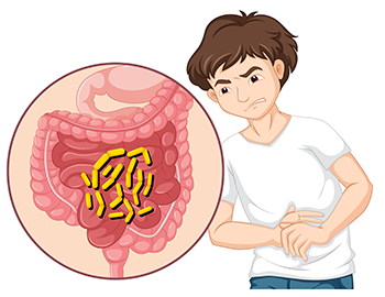 diverticuliis foods to avoid